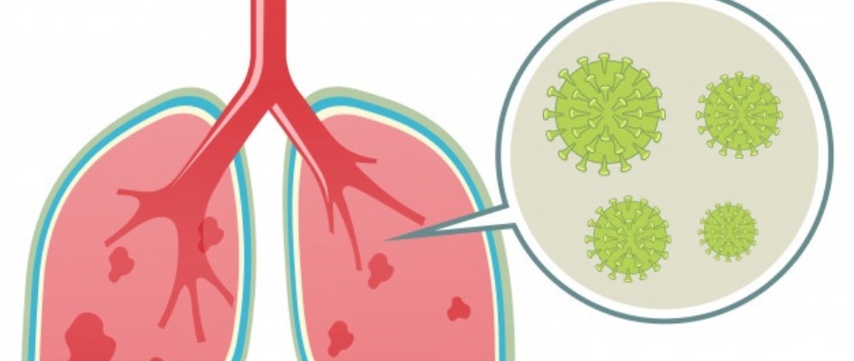 coronavirus-pulmones-humanos